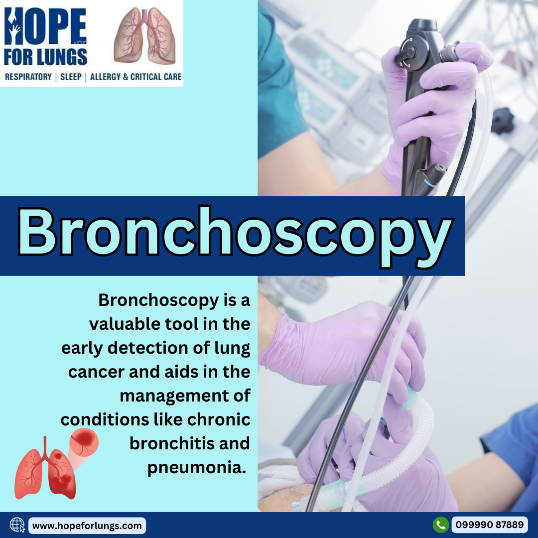 Bronchoscopy